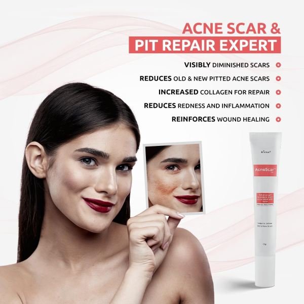 AcneScar Gel anti acne